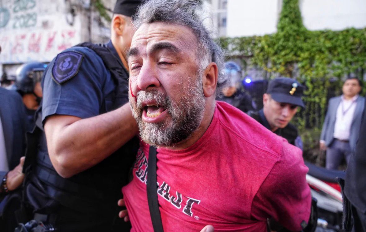 represion a la prensa